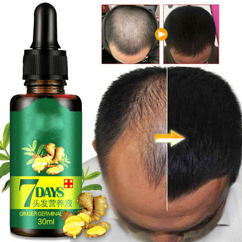 Ginger Hair Growth Essence 7 Days Germinal Hair Growth Serum Essence Oil Hair Loss Treatement Growth Hair for Men Women