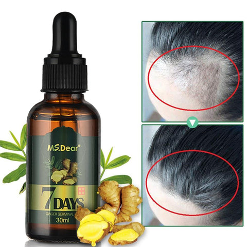 Hair Growth Essential Oils Ginger Germinal Oil Fast Hair Growth Anti-Hair Loss Alopecia Treatment Beauty Dense Hair Growth Serum